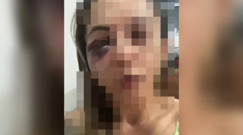 Mulher sofre tentativa de feminicídio e tem o rosto desfigurado por companheiro, em Valparaíso