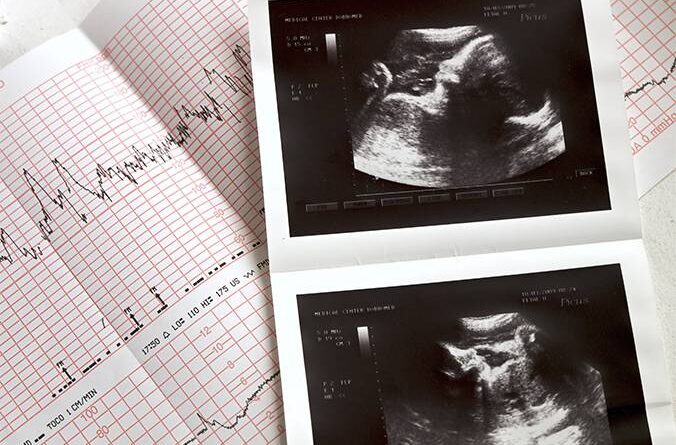 Hospital da Mulher realizará mutirão de ecocardiograma fetal