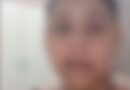 Adolescente com câncer é vítima de bullying em escola pública de Luziânia