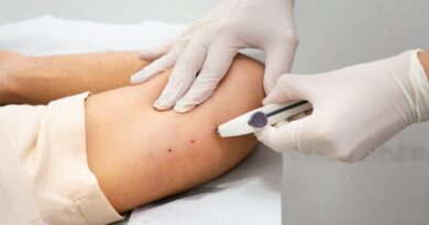 Cidade Ocidental capacita profissionais para ampliar oferta do Implanon no município