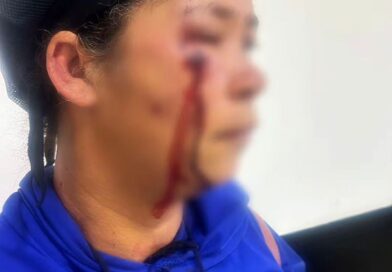Mulher é agredida após ser acusada de relação com homem casado, agressoras foram presas Mulher é agredida após ser acusada de relação com homem casado, agressoras foram presas
