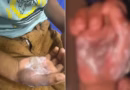 Justiça concede medida protetiva para criança de 7 anos que teve mãos queimadas pela mãe em Cidade Ocidental